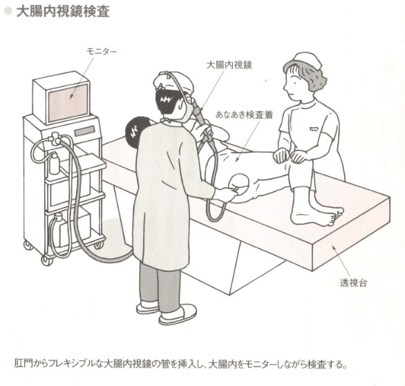 大腸内視鏡検査